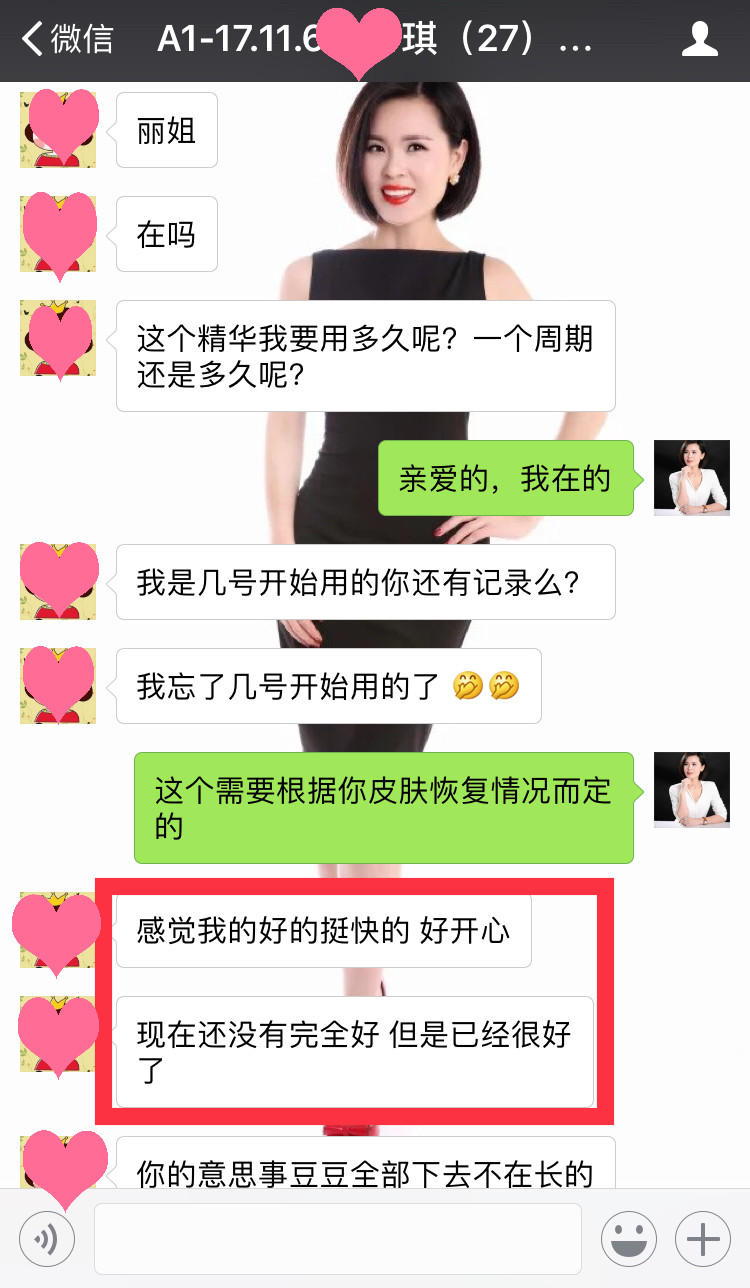 下巴長痘痘怎么解決？下巴都是痘痘怎么辦，不要盲目選擇,快看這里