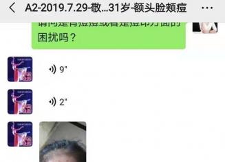 額頭上的閉合性粉刺怎么去除？分享下舞蹈老師敬敬的經驗