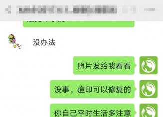 丘疹型痘痘怎么辦？看小付如何成功蛻變