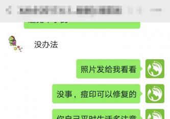 丘疹型痘痘怎么辦？看小付如何成功蛻變